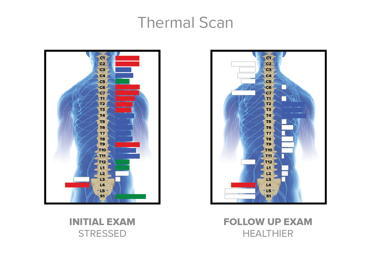 Thermal-Scan-1